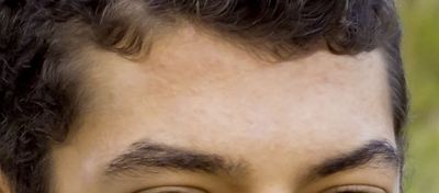 forehead after dust scratches for chin and lip.JPG